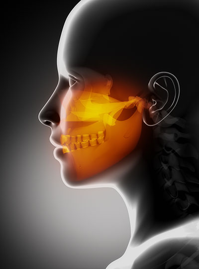X-ray image of maxillofacial region of a person at The Center for Esthetic Dentistry.