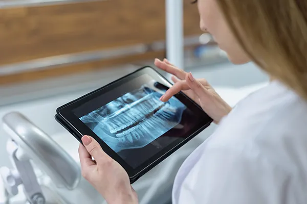 Dentist looking at xray atThe Center for Esthetic Dentistry in Grants Pass, OR