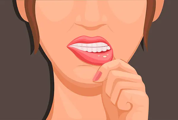 A woman inspects a visible mouth ulcer, a potential symptom of oral cancer, emphasizing the importance of oral cancer screening.